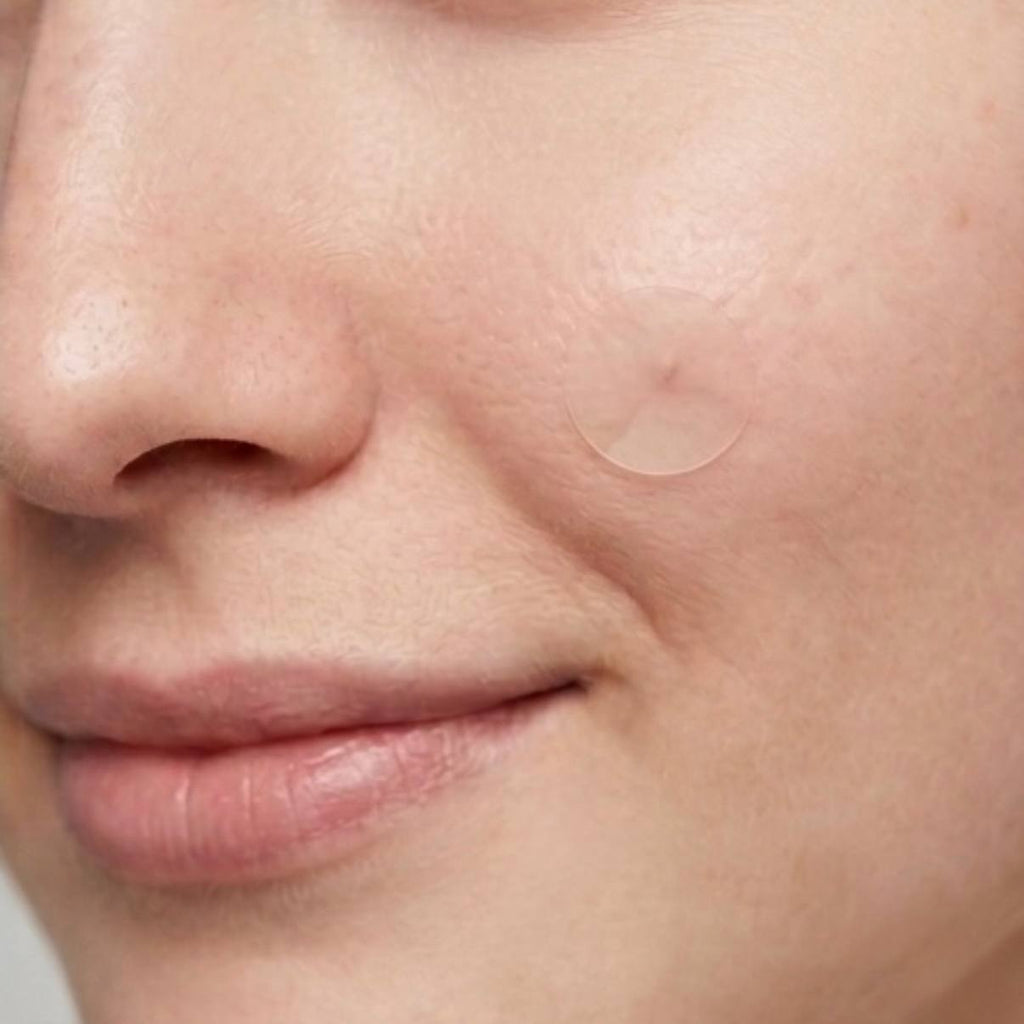 Patches Boutons